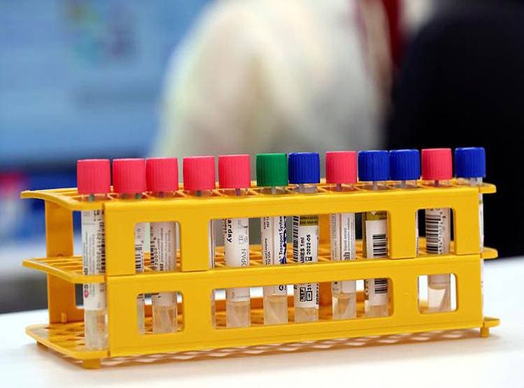 कोरोना के खात्मे की दिशा में बड़ा कदम, दुनिया भर में 4 दवाओं का महा-परीक्षण शुरू