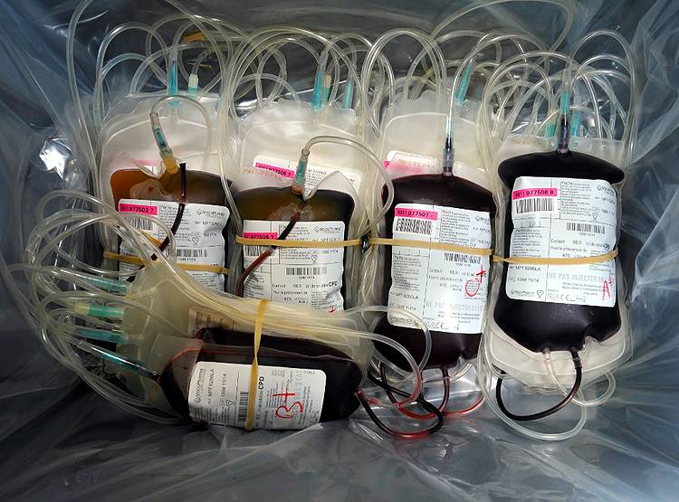 क्या है खून से कोरोना के इलाज की तकनीक, जिससे लोग हो रहे ठीक