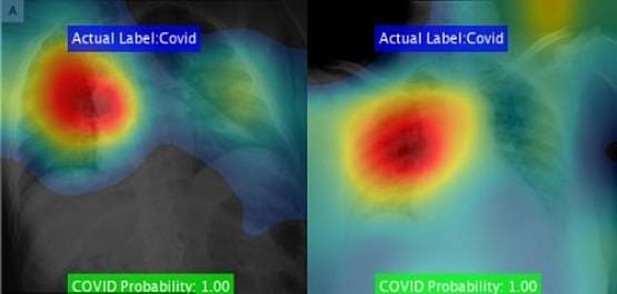 वैज्ञानिक का दावा- नहीं छिप सकेगा कोरोना, चुटकी में पकड़ेगा सॉफ्टवेयर