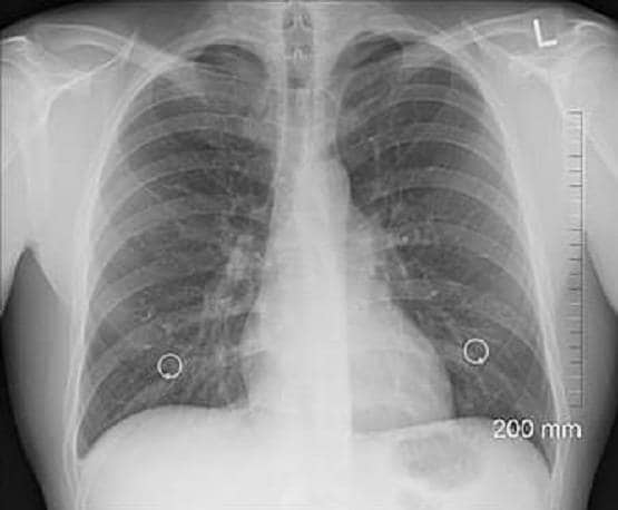 वैज्ञानिक का दावा- नहीं छिप सकेगा कोरोना, चुटकी में पकड़ेगा सॉफ्टवेयर
