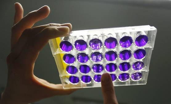 अमेरिकी क्यों मान रहे कि कोरोना वायरस को लैब में पैदा किया गया?