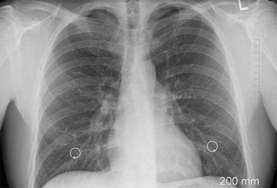 भारत में रूप बदल रहा है कोरोना, वैक्सीन की खोज को लग सकता है पलीता!