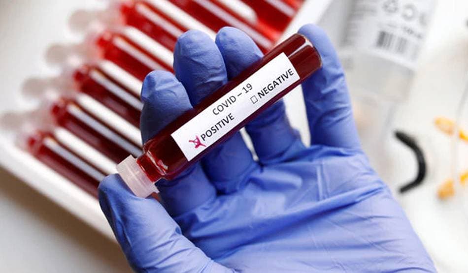 देश की इस कंपनी ने तैयार की कोरोना वायरस की एंटीबॉडी किट