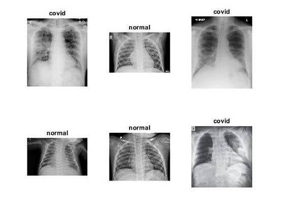 वैज्ञानिक का दावा- नहीं छिप सकेगा कोरोना, चुटकी में पकड़ेगा सॉफ्टवेयर