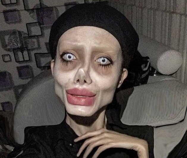 (morning)हॉलीवुड एक्‍ट्रेस की तरह दिखने के लिए इस युवती ने कराई थी 50 सर्जरी, जेल में हुआ कोरोना