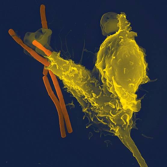 ये चीज खाने से इम्यूनिटी पर पड़ता है बुरा असर, ऐसे बैलेंस करें डाइट