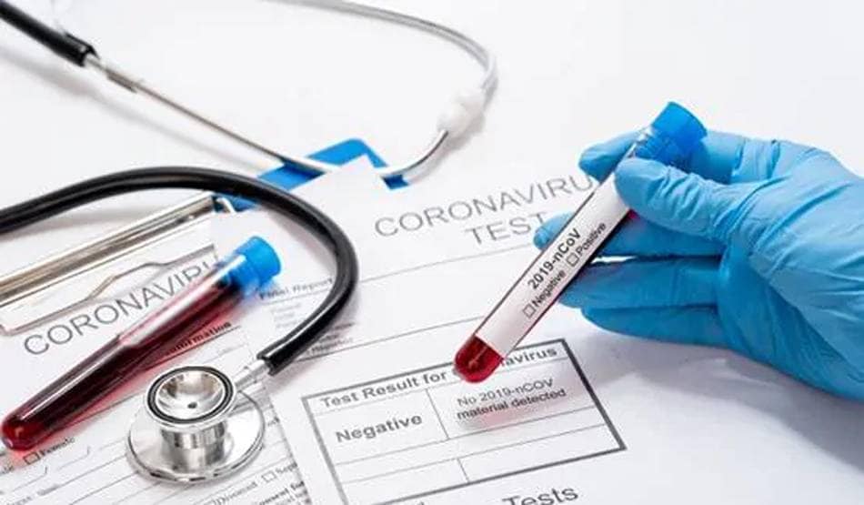 देश की इस कंपनी ने तैयार की कोरोना वायरस की एंटीबॉडी किट