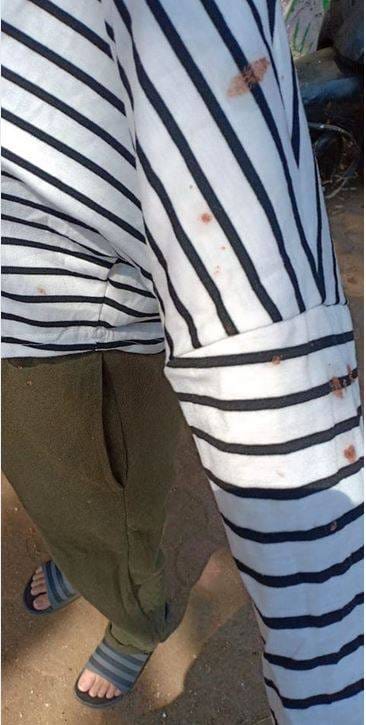 लॉकडाउन के बीच युवती को 'कोरोना वायरस' बताकर थूक दी पीक