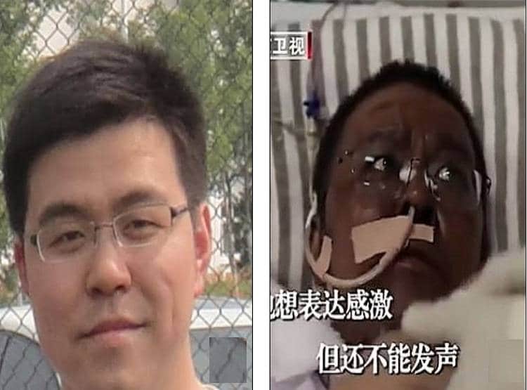 कोरोना: वुहान के दो डॉक्टरों का बदला रंग, संक्रमित होने पर काला पड़ा चेहरा