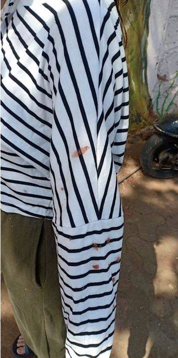 लॉकडाउन के बीच युवती को 'कोरोना वायरस' बताकर थूक दी पीक