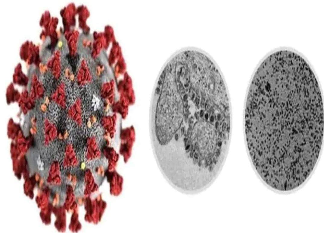 लॉकडाउन में नहीं मिल रही शराब, पी गया सैनिटाइजर और फिर...