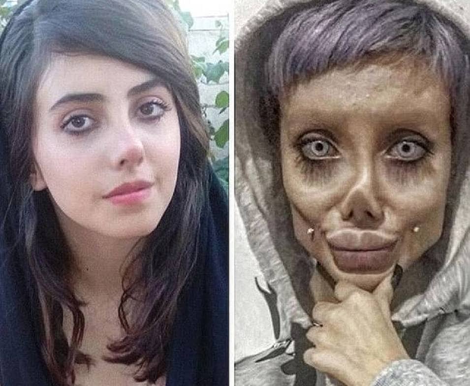 (morning)हॉलीवुड एक्‍ट्रेस की तरह दिखने के लिए इस युवती ने कराई थी 50 सर्जरी, जेल में हुआ कोरोना