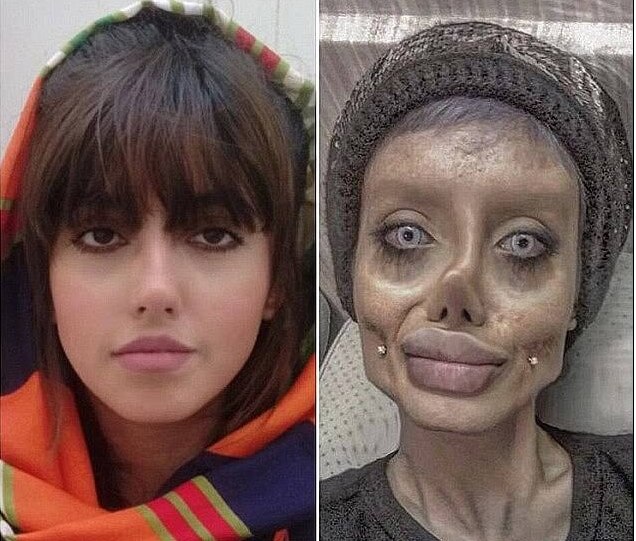 (morning)हॉलीवुड एक्‍ट्रेस की तरह दिखने के लिए इस युवती ने कराई थी 50 सर्जरी, जेल में हुआ कोरोना