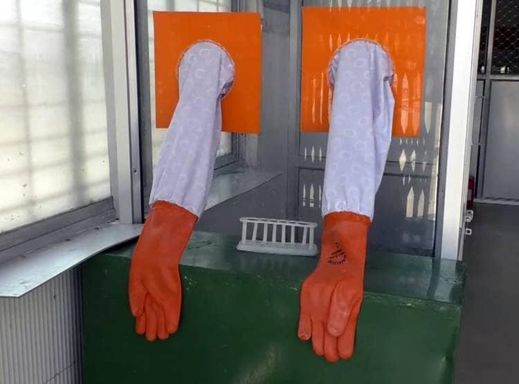 कोरोना से बचने का डॉक्टरों का अनोखा जुगाड़, बिना छुए कर रहे इलाज