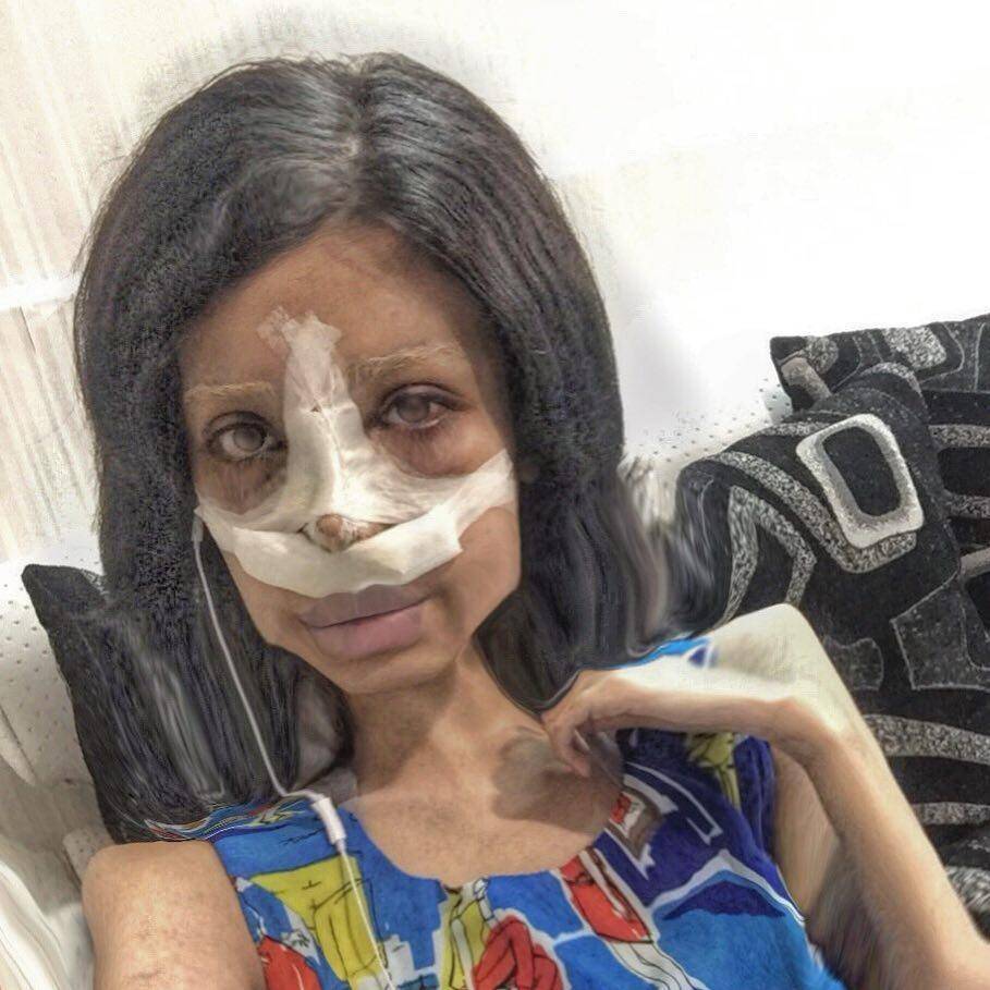 (morning)हॉलीवुड एक्‍ट्रेस की तरह दिखने के लिए इस युवती ने कराई थी 50 सर्जरी, जेल में हुआ कोरोना