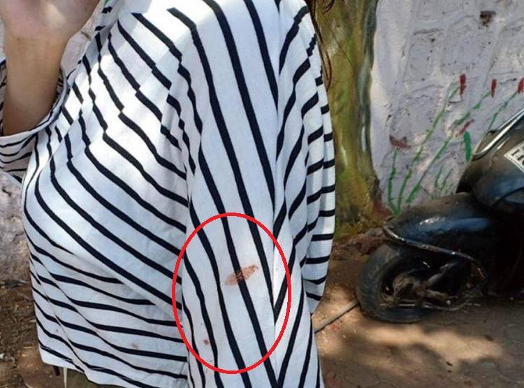 लॉकडाउन के बीच युवती को 'कोरोना वायरस' बताकर थूक दी पीक