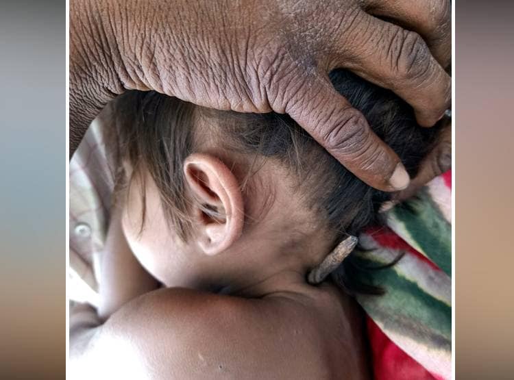 मासूम की गर्दन से आर-पार निकला तीर, शिकारी को तलाश रही पुलिस