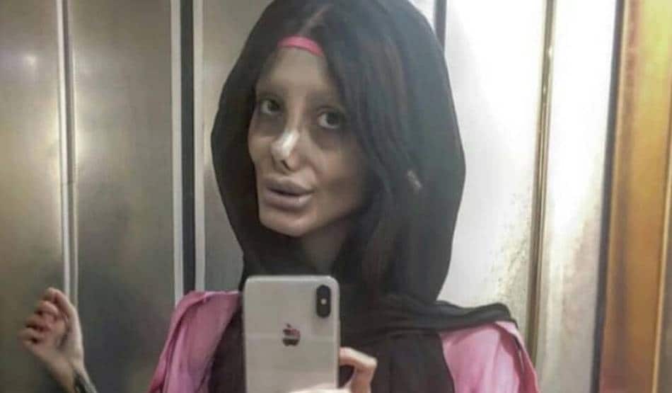 (morning)हॉलीवुड एक्‍ट्रेस की तरह दिखने के लिए इस युवती ने कराई थी 50 सर्जरी, जेल में हुआ कोरोना