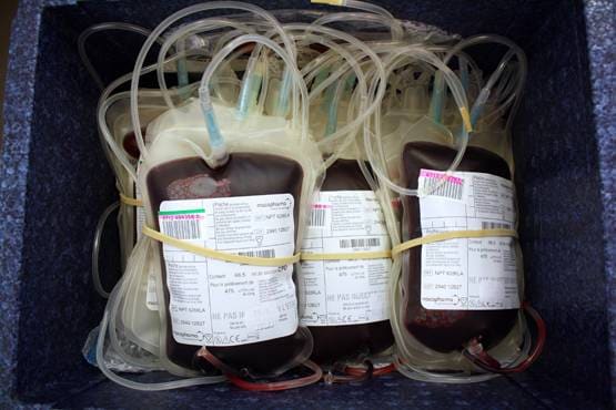 10 लाख रुपये प्रति लीटर बिक रहा कोरोना से ठीक हुए मरीजों का खून