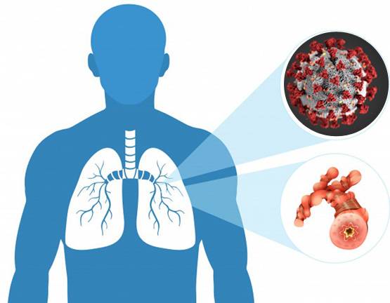 वैज्ञानिकों ने कोरोना की वैक्सीन को लेकर कही निराश करने वाली बात