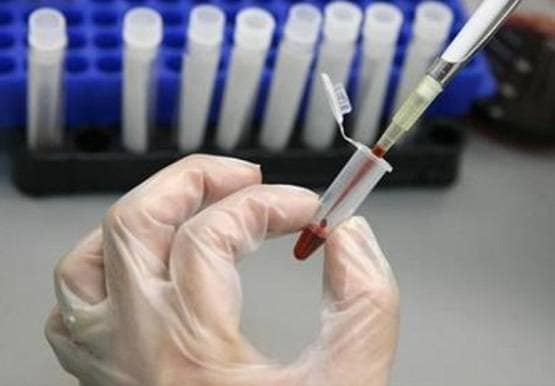 इस नशीली चीज से बन सकती है कोरोना की वैक्सीन! इंसानों पर होगा ट्रायल