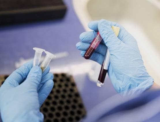 वैज्ञानिकों ने कोरोना की वैक्सीन को लेकर कही निराश करने वाली बात