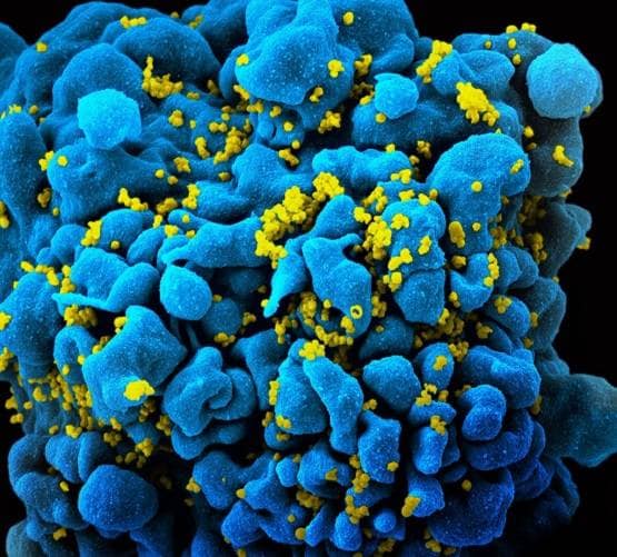 ...इसलिए आज तक नहीं बन पाई HIV एड्स की वैक्सीन, कोरोना में भी यही डर