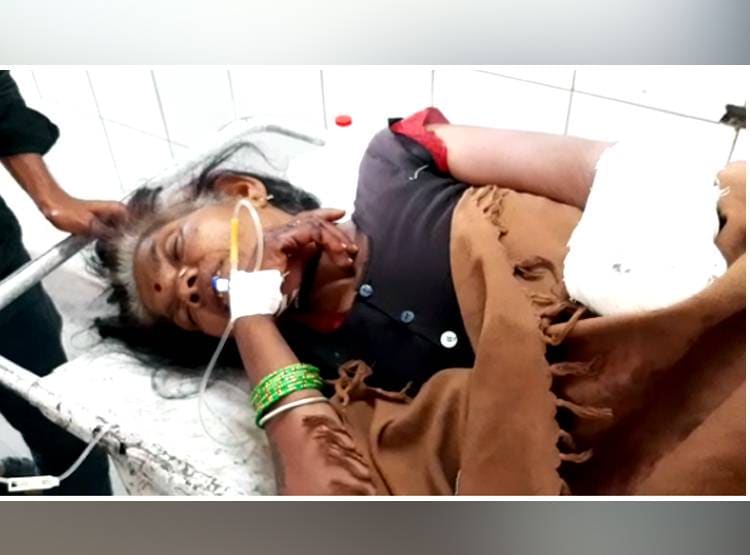 नदी से पानी पी रही थी महिला, मगरमच्छ ने हमला कर चबा लिया हाथ