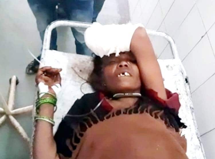 नदी से पानी पी रही थी महिला, मगरमच्छ ने हमला कर चबा लिया हाथ