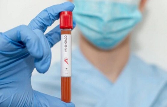 corona virus vaccine