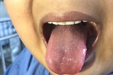 रहस्यमय सिंड्रोम से US में बच्चों की मौतें, क्या इसका कोरोना कनेक्शन है?