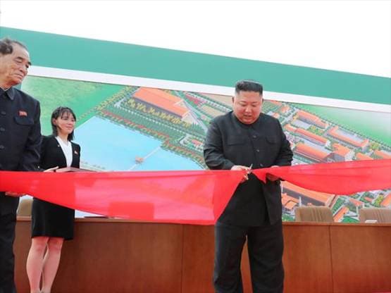 20 दिन बाद सामने आए किम जोंग के शरीर पर रहस्यमय निशान, डॉक्टरों ने कही ये बात