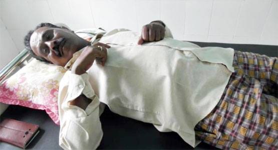 कोबरा ने इंसान को काटा, सांप की मौत लेकिन जिंदा रहा शख्स