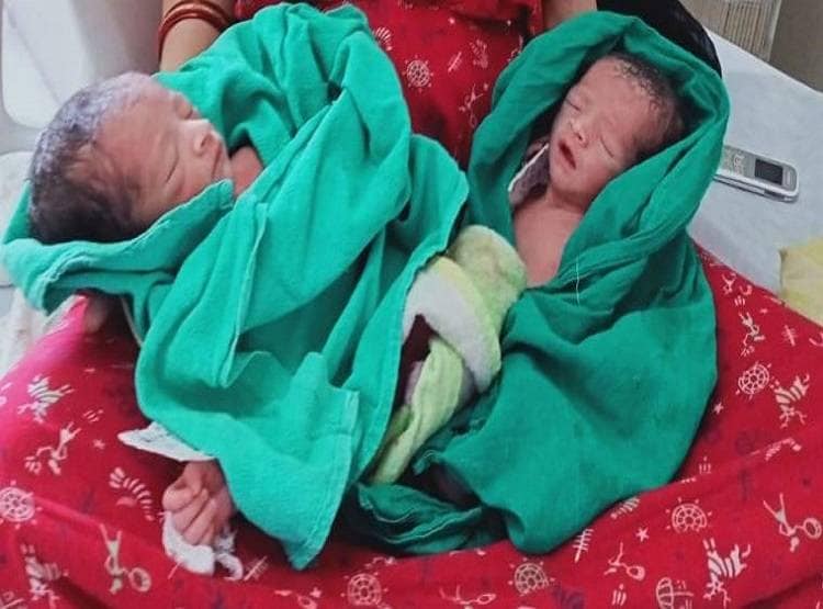 कोरोना संक्रमित मां ने जुड़वां बच्चों को दिया जन्म, दोनों स्वस्थ