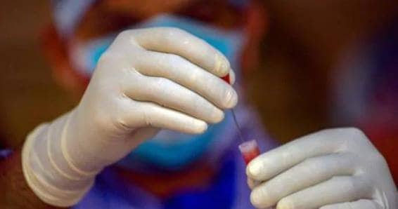 एक्सपर्ट का दावा- सालभर से पहले भारत में वैक्सीन बनने की संभावना कम