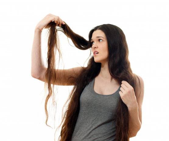 झड़ते बालों से हैं परेशान तो अपनी डाइट में शामिल करें ये तीन चीजें