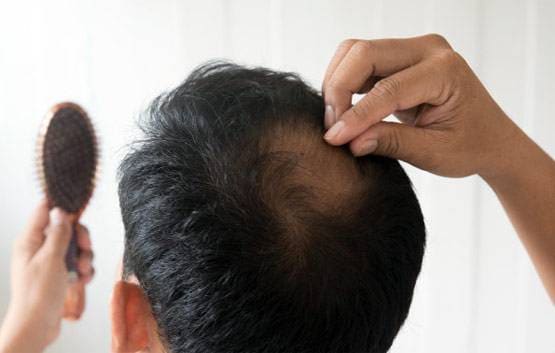 झड़ते बालों से हैं परेशान तो अपनी डाइट में शामिल करें ये तीन चीजें