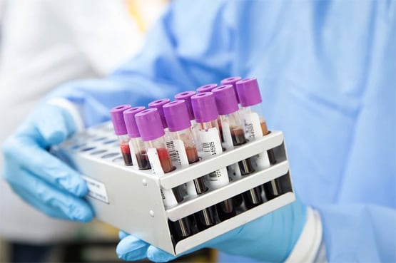 कोरोना वैक्सीन की जुलाई तक लाखों डोज बनाएगी भारत की ये कंपनी