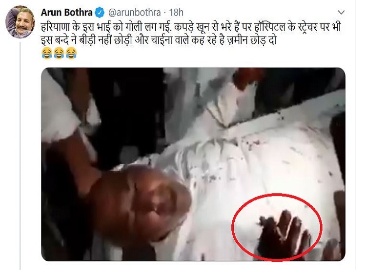 गोली लगने के बाद भी स्ट्रेचर पर बीड़ी पीता रहा शख्स, वीडियो वायरल