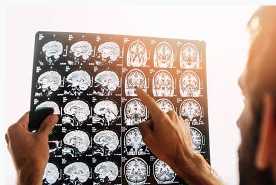 इन लक्षणों को ना करें नजरअंदाज,  हो सकता है ब्रेन ट्यूमर का खतरा