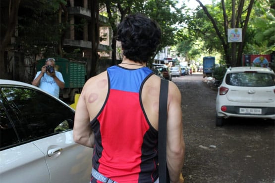 टाइगर श्रॉफ की पीठ पर ये कैसे निशान, क्या एक्टर ने कराई कपिंग थेरेपी?