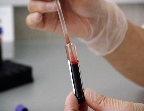 कोरोना वैक्सीन की जुलाई तक लाखों डोज बनाएगी भारत की ये कंपनी