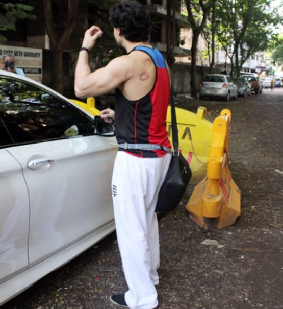 टाइगर श्रॉफ की पीठ पर ये कैसे निशान, क्या एक्टर ने कराई कपिंग थेरेपी?