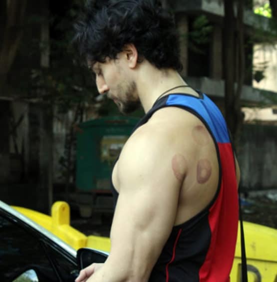 टाइगर श्रॉफ की पीठ पर ये कैसे निशान, क्या एक्टर ने कराई कपिंग थेरेपी?