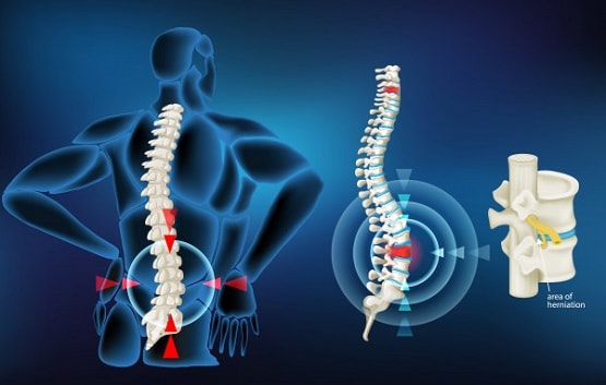 कमर दर्द पर समय रहते पा लें काबू, जानें कितना खतरनाक है ये रोग