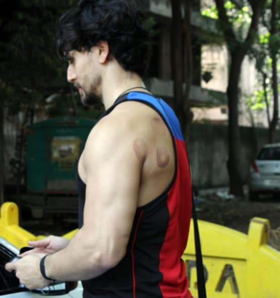 टाइगर श्रॉफ की पीठ पर ये कैसे निशान, क्या एक्टर ने कराई कपिंग थेरेपी?