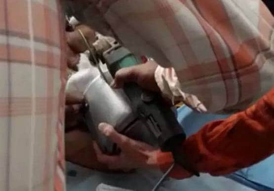 कुकर में फंस गया मासूम का सिर, डॉक्टर भी हुए फेल तो ऐसे निकाला