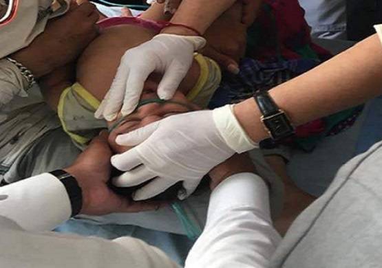 कुकर में फंस गया मासूम का सिर, डॉक्टर भी हुए फेल तो ऐसे निकाला