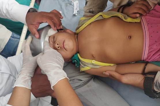 कुकर में फंस गया मासूम का सिर, डॉक्टर भी हुए फेल तो ऐसे निकाला