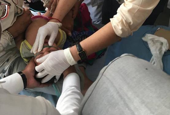 कुकर में फंस गया मासूम का सिर, डॉक्टर भी हुए फेल तो ऐसे निकाला